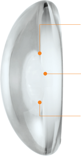 Cohesive Gel Implant Structure